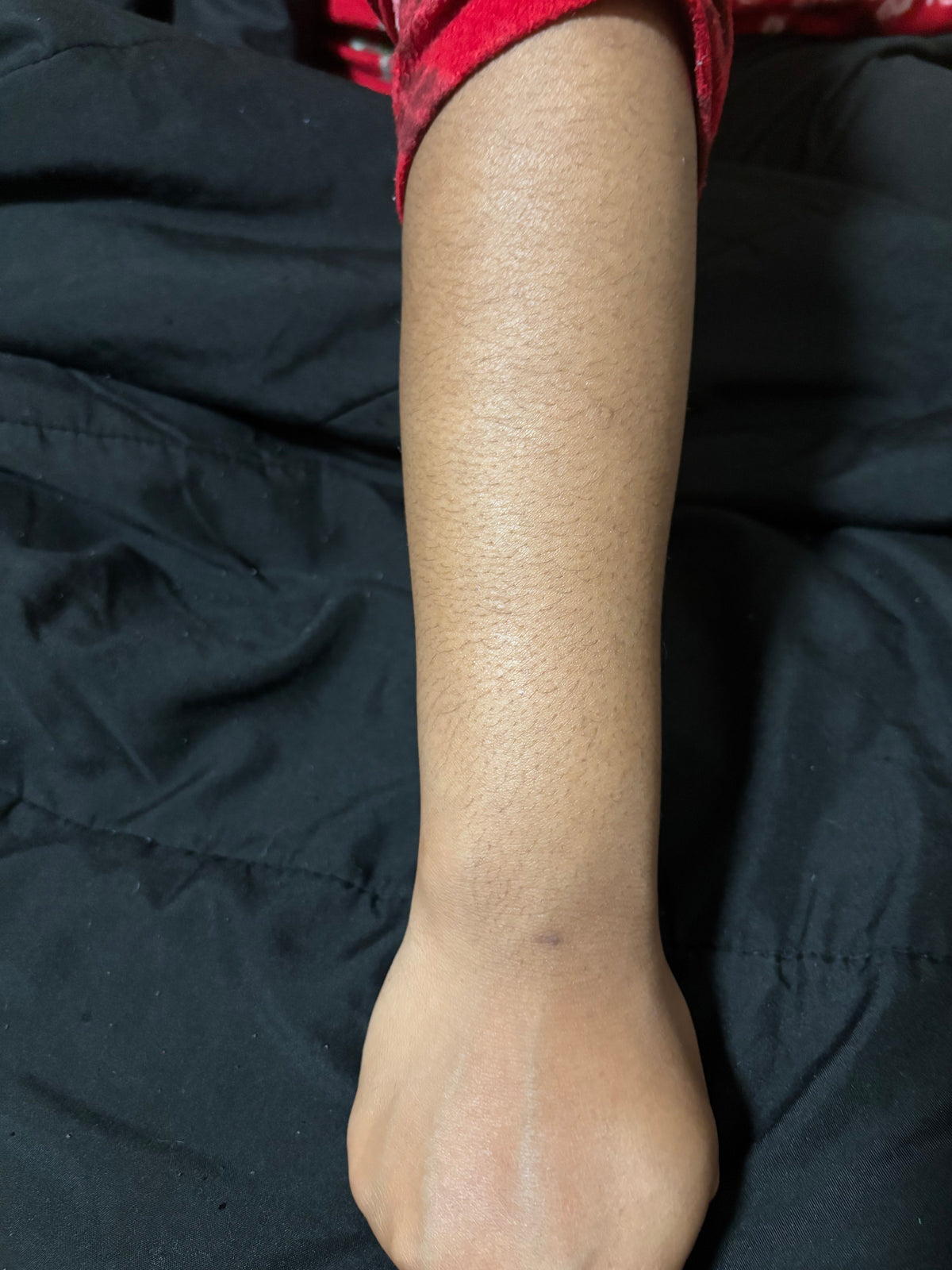 After using the salve